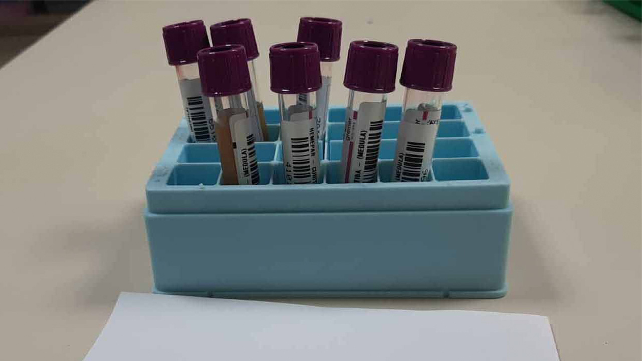 Fevereiro Laranja: mês da conscientização sobre leucemia reforça importância do diagnóstico