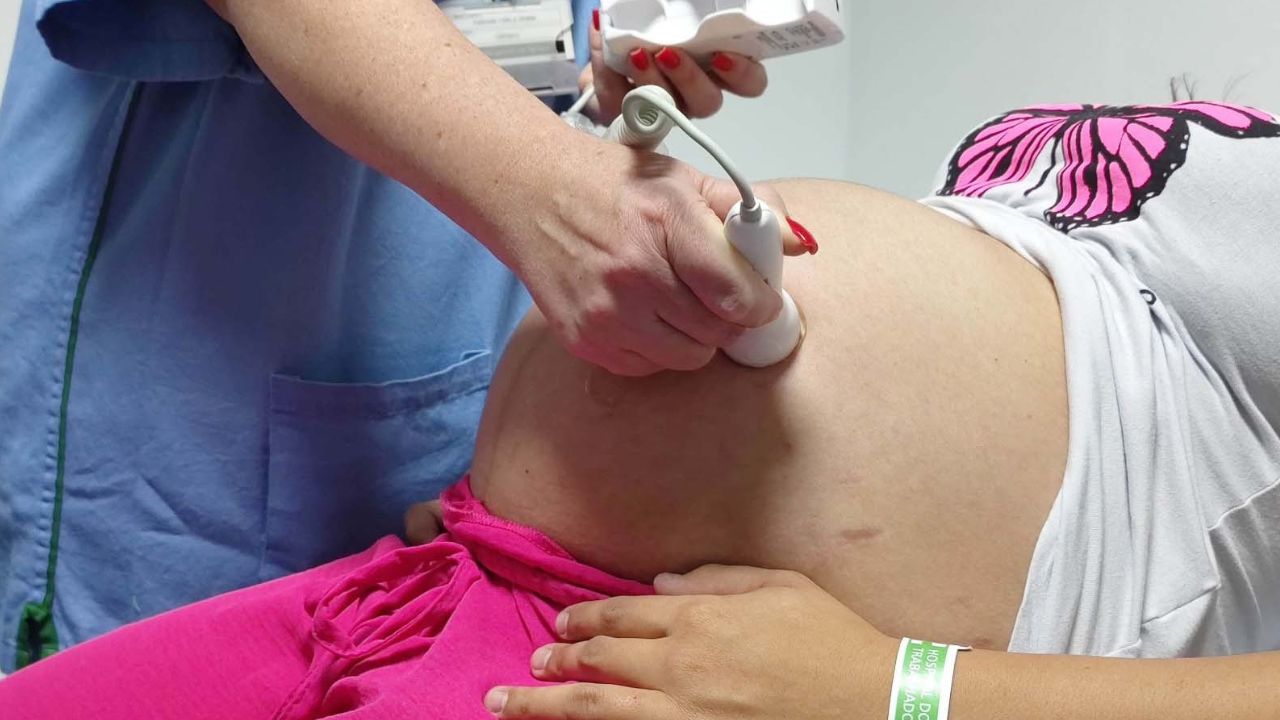 Ultrassom morfológico passa a ser ofertado a 100% das gestantes atendidas no Paraná